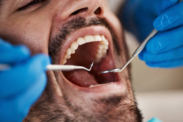 Best 24-Hour Emergency Dental Care in Ridgecrest, FL