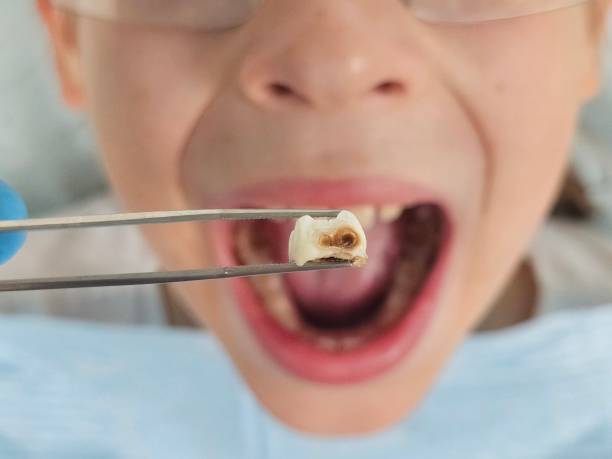 Best Emergency Cosmetic Dentistry (e.g., broken veneers) in Ridgecrest, FL